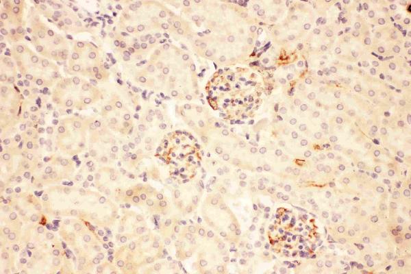 IHC analysis of ACTH using anti-ACTH antibody (PB9039).