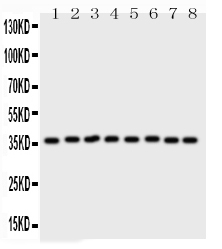 Western blot analysis of Annexin V using anti-Annexin V antibody (PB9044). Electrophoresis was performed on a 5-20% SDS-PAGE gel at 70V (Stacking gel) / 90V (Resolving gel) for 2-3 hours. The sample well of each lane was loaded with 50ug of sample under reducing conditions. Lane 1: Rat Lung Tissue Lysate Lane 2: Rat Brain Tissue Lysate Lane 3: Rat Cardiac Muscle Tissue Lysate Lane 4: Rat Kidney Tissue Lysate Lane 5: HELA Whole Cell Lysate Lane 6: SMMC Whole Cell Lysate Lane 7: A549 Whole Cell Lysate Lane 8: SGC Whole Cell Lysate After Electrophoresis, proteins were transferred to a Nitrocellulose membrane at 150mA for 50-90 minutes. Blocked the membrane with 5% Non-fat Milk/ TBS for 1.5 hour at RT. The membrane was incubated with rabbit anti-Annexin V antigen affinity purified polyclonal antibody (Catalog # PB9044) at 0.5 μg/mL overnight at 4°C, then washed with TBS-0.1%Tween 3 times with 5 minutes each and probed with a goat anti-rabbit IgG-HRP secondary antibody at a dilution of 1:10000 for 1.5 hour at RT. The signal is developed using an Enhanced Chemiluminescent detection (ECL) kit (Catalog # EK1002) with Tanon 5200 system. A specific band was detected for Annexin V at approximately 36KD. The expected band size for Annexin V is at 36KD.