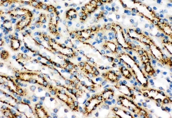 IHC analysis of Cathepsin D using anti-Cathepsin D antibody (PB9048). Cathepsin D was detected in paraffin-embedded section of Mouse Kidney Tissue. Heat mediated antigen retrieval was performed in citrate buffer (pH6, epitope retrieval solution) for 20 mins. The tissue section was blocked with 10% goat serum. The tissue section was then incubated with 1μg/ml rabbit anti-Cathepsin D Antibody (PB9048) overnight at 4°C. Biotinylated goat anti-rabbit IgG was used as secondary antibody and incubated for 30 minutes at 37°C. The tissue section was developed using Strepavidin-Biotin-Complex (SABC)(Catalog # SA1022) with DAB as the chromogen.