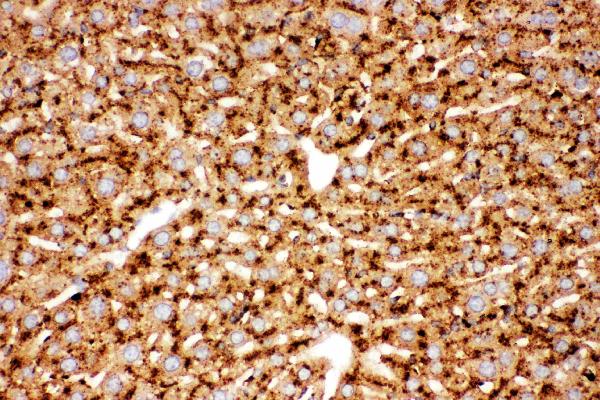 IHC analysis of Cathepsin D using anti-Cathepsin D antibody (PB9048). Cathepsin D was detected in paraffin-embedded section of Mouse Liver Tissue. Heat mediated antigen retrieval was performed in citrate buffer (pH6, epitope retrieval solution) for 20 mins. The tissue section was blocked with 10% goat serum. The tissue section was then incubated with 1μg/ml rabbit anti-Cathepsin D Antibody (PB9048) overnight at 4°C. Biotinylated goat anti-rabbit IgG was used as secondary antibody and incubated for 30 minutes at 37°C. The tissue section was developed using Strepavidin-Biotin-Complex (SABC)(Catalog # SA1022) with DAB as the chromogen.