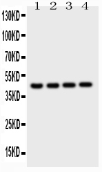 Western blot analysis of Cathepsin D using anti-Cathepsin D antibody (PB9048). Electrophoresis was performed on a 5-20% SDS-PAGE gel at 70V (Stacking gel) / 90V (Resolving gel) for 2-3 hours. The sample well of each lane was loaded with 50ug of sample under reducing conditions. Lane 1: Mouse Liver Tissue Lysate Lane 2: Mouse Brain Tissue Lysate Lane 3: Mouse Thymus Tissue Lysate Lane 4: NEURO Whole Cell Lysate After Electrophoresis, proteins were transferred to a Nitrocellulose membrane at 150mA for 50-90 minutes. Blocked the membrane with 5% Non-fat Milk/ TBS for 1.5 hour at RT. The membrane was incubated with rabbit anti-Cathepsin D antigen affinity purified polyclonal antibody (Catalog # PB9048) at 0.5 μg/mL overnight at 4°C, then washed with TBS-0.1%Tween 3 times with 5 minutes each and probed with a goat anti-rabbit IgG-HRP secondary antibody at a dilution of 1:10000 for 1.5 hour at RT. The signal is developed using an Enhanced Chemiluminescent detection (ECL) kit (Catalog # EK1002) with Tanon 5200 system. A specific band was detected for Cathepsin D at approximately 45KD. The expected band size for Cathepsin D is at 45KD.