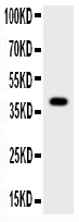 Western blot analysis of Cathepsin G using anti-Cathepsin G antibody (A04887-1).