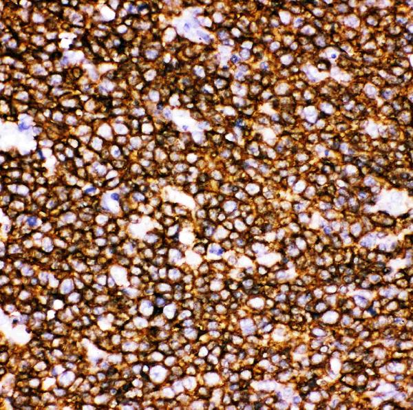 IHC analysis of CD20 using anti-CD20 antibody (PB9050). CD20 was detected in paraffin-embedded section of Human Tonsil Tissue. Heat mediated antigen retrieval was performed in citrate buffer (pH6, epitope retrieval solution) for 20 mins. The tissue section was blocked with 10% goat serum. The tissue section was then incubated with 1μg/ml rabbit anti-CD20 Antibody (PB9050) overnight at 4°C. Biotinylated goat anti-rabbit IgG was used as secondary antibody and incubated for 30 minutes at 37°C. The tissue section was developed using Strepavidin-Biotin-Complex (SABC)(Catalog # SA1022) with DAB as the chromogen.