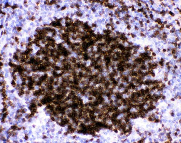 IHC analysis of CD23 using anti-CD23 antibody (PB9051). CD23 was detected in paraffin-embedded section of Mouse Spleen Tissue. Heat mediated antigen retrieval was performed in citrate buffer (pH6, epitope retrieval solution) for 20 mins. The tissue section was blocked with 10% goat serum. The tissue section was then incubated with 1μg/ml rabbit anti-CD23 Antibody (PB9051) overnight at 4°C. Biotinylated goat anti-rabbit IgG was used as secondary antibody and incubated for 30 minutes at 37°C. The tissue section was developed using Strepavidin-Biotin-Complex (SABC)(Catalog # SA1022) with DAB as the chromogen.