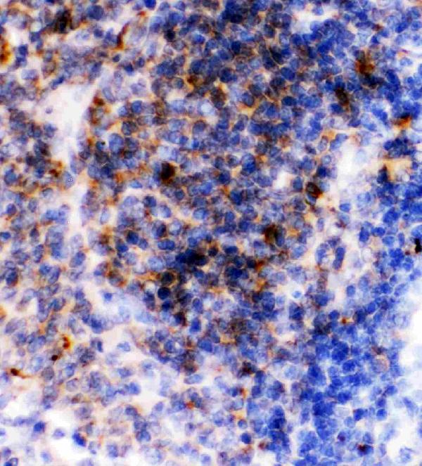 IHC analysis of CD23 using anti-CD23 antibody (PB9051). CD23 was detected in paraffin-embedded section of Rat Spleen Tissue. Heat mediated antigen retrieval was performed in citrate buffer (pH6, epitope retrieval solution) for 20 mins. The tissue section was blocked with 10% goat serum. The tissue section was then incubated with 1μg/ml rabbit anti-CD23 Antibody (PB9051) overnight at 4°C. Biotinylated goat anti-rabbit IgG was used as secondary antibody and incubated for 30 minutes at 37°C. The tissue section was developed using Strepavidin-Biotin-Complex (SABC)(Catalog # SA1022) with DAB as the chromogen.