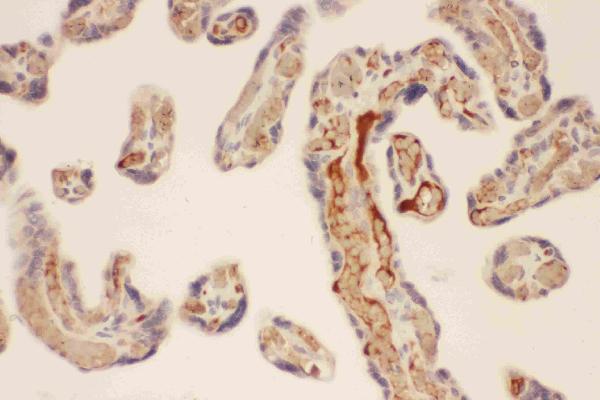 IHC analysis of CMA1 using anti-CMA1 antibody (PB9055).