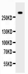 Western blot analysis of VWF using anti-VWF antibody (PB9062). Electrophoresis was performed on a 5-20% SDS-PAGE gel at 70V (Stacking gel) / 90V (Resolving gel) for 2-3 hours. The sample well of each lane was loaded with 50ug of sample under reducing conditions. Lane 1: HT1080 Whole Cell Lysate. After Electrophoresis, proteins were transferred to a Nitrocellulose membrane at 150mA for 50-90 minutes. Blocked the membrane with 5% Non-fat Milk/ TBS for 1.5 hour at RT. The membrane was incubated with rabbit anti-VWF antigen affinity purified polyclonal antibody (Catalog # PB9062) at 0.5 μg/mL overnight at 4°C, then washed with TBS-0.1%Tween 3 times with 5 minutes each and probed with a goat anti-rabbit IgG-HRP secondary antibody at a dilution of 1:10000 for 1.5 hour at RT. The signal is developed using an Enhanced Chemiluminescent detection (ECL) kit (Catalog # EK1002) with Tanon 5200 system. A specific band was detected for VWF at approximately 309KD. The expected band size for VWF is at 309KD.