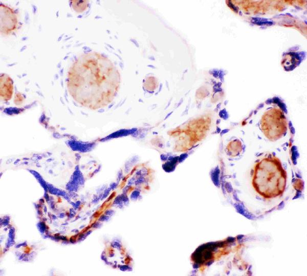 IHC analysis of Wnt5a using anti-Wnt5a antibody (PB9063).