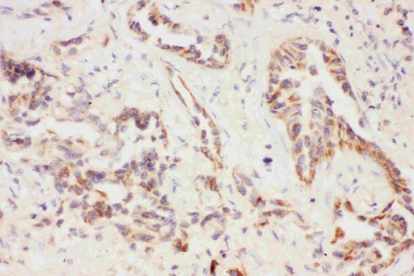 IHC analysis of Eotaxin 3 using anti-Eotaxin 3 antibody (PB9066).