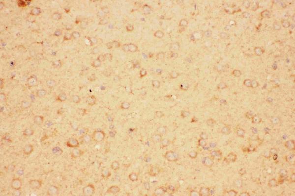 IHC analysis of CNTF using anti-CNTF antibody (PB9067).