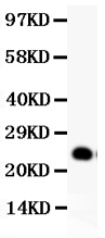 Western blot analysis of GDNF using anti-GDNF antibody (PB9069).