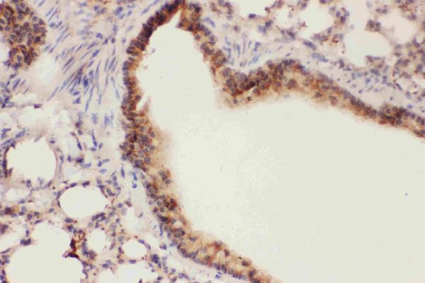 IHC analysis of ALOX15 using anti-ALOX15 antibody (PB9073).