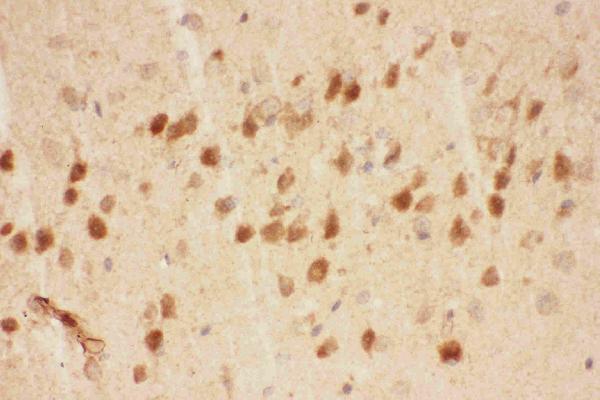 IHC analysis of BDNF using anti-BDNF antibody (PB9075). BDNF was detected in paraffin-embedded section of Mouse Brain Tissue. Heat mediated antigen retrieval was performed in citrate buffer (pH6, epitope retrieval solution) for 20 mins. The tissue section was blocked with 10% goat serum. The tissue section was then incubated with 1μg/ml rabbit anti-BDNF Antibody (PB9075) overnight at 4°C. Biotinylated goat anti-rabbit IgG was used as secondary antibody and incubated for 30 minutes at 37°C. The tissue section was developed using Strepavidin-Biotin-Complex (SABC)(Catalog # SA1022) with DAB as the chromogen.