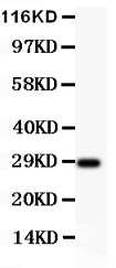 Western blot analysis of BDNF using anti-BDNF antibody (PB9075). Electrophoresis was performed on a 5-20% SDS-PAGE gel at 70V (Stacking gel) / 90V (Resolving gel) for 2-3 hours. The sample well of each lane was loaded with 50ug of sample under reducing conditions. Lane 1: Rat Brain Tissue Lysate After Electrophoresis, proteins were transferred to a Nitrocellulose membrane at 150mA for 50-90 minutes. Blocked the membrane with 5% Non-fat Milk/ TBS for 1.5 hour at RT. The membrane was incubated with rabbit anti-BDNF antigen affinity purified polyclonal antibody (Catalog # PB9075) at 0.5 μg/mL overnight at 4°C, then washed with TBS-0.1%Tween 3 times with 5 minutes each and probed with a goat anti-rabbit IgG-HRP secondary antibody at a dilution of 1:10000 for 1.5 hour at RT. The signal is developed using an Enhanced Chemiluminescent detection (ECL) kit (Catalog # EK1002) with Tanon 5200 system. A specific band was detected for BDNF at approximately 28KD. The expected band size for BDNF is at 28KD.