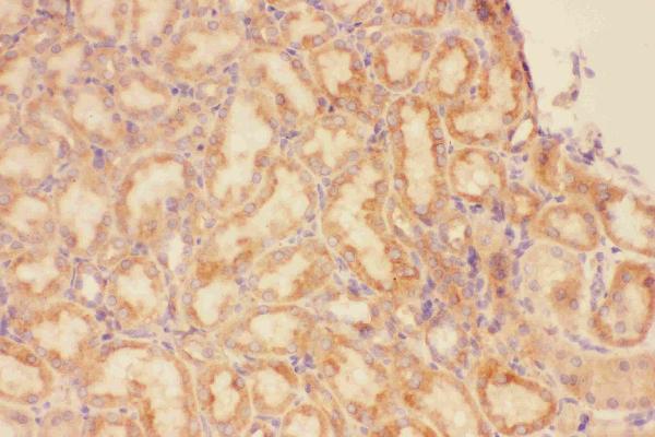 IHC analysis of CXCR3 using anti-CXCR3 antibody (PB9079).