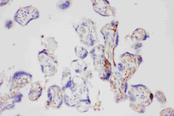 IHC analysis of Galectin-3 using anti-Galectin-3 antibody (PB9081). Galectin-3 was detected in paraffin-embedded section of Human Placenta Tissue. Heat mediated antigen retrieval was performed in citrate buffer (pH6, epitope retrieval solution) for 20 mins. The tissue section was blocked with 10% goat serum. The tissue section was then incubated with 1μg/ml rabbit anti-Galectin-3 Antibody (PB9081) overnight at 4°C. Biotinylated goat anti-rabbit IgG was used as secondary antibody and incubated for 30 minutes at 37°C. The tissue section was developed using Strepavidin-Biotin-Complex (SABC)(Catalog # SA1022) with DAB as the chromogen.