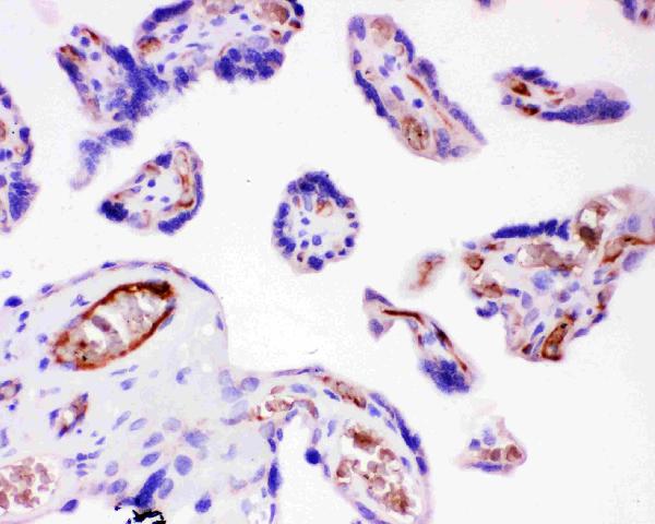 IHC analysis of ITGB1 using anti-ITGB1 antibody (PB9086).