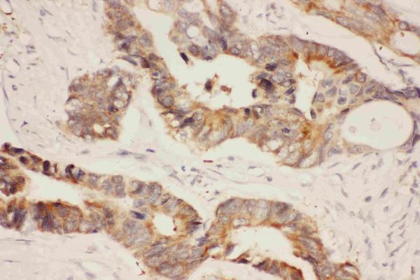 IHC analysis of Hsp90 Alpha using anti-Hsp90 Alpha antibody (PB9089).