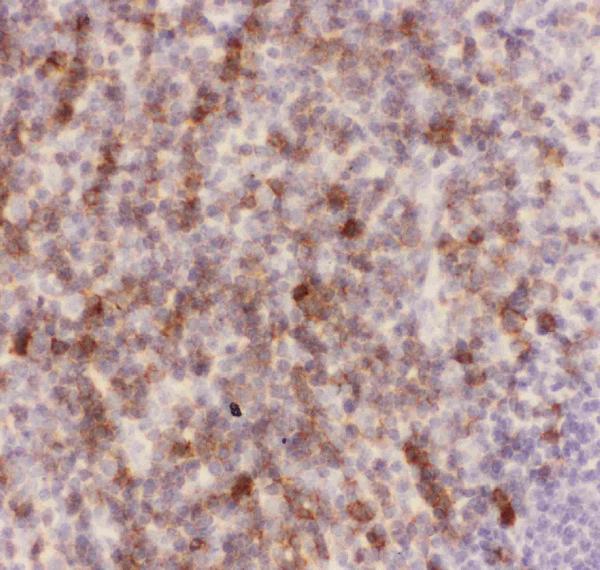 IHC analysis of CD43 using anti-CD43 antibody (PB9095). CD43 was detected in paraffin-embedded section of mouse spleen tissues. Heat mediated antigen retrieval was performed in citrate buffer (pH6, epitope retrieval solution) for 20 mins. The tissue section was blocked with 10% goat serum. The tissue section was then incubated with 1μg/ml rabbit anti-CD43 Antibody (PB9095) overnight at 4°C. Biotinylated goat anti-rabbit IgG was used as secondary antibody and incubated for 30 minutes at 37°C. The tissue section was developed using Strepavidin-Biotin-Complex (SABC)(Catalog # SA1022) with DAB as the chromogen.