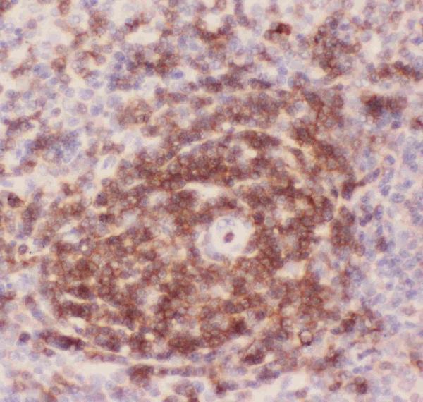 IHC analysis of CD43 using anti-CD43 antibody (PB9095). CD43 was detected in paraffin-embedded section of rat spleen tissues. Heat mediated antigen retrieval was performed in citrate buffer (pH6, epitope retrieval solution) for 20 mins. The tissue section was blocked with 10% goat serum. The tissue section was then incubated with 1μg/ml rabbit anti-CD43 Antibody (PB9095) overnight at 4°C. Biotinylated goat anti-rabbit IgG was used as secondary antibody and incubated for 30 minutes at 37°C. The tissue section was developed using Strepavidin-Biotin-Complex (SABC)(Catalog # SA1022) with DAB as the chromogen.