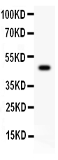 Western blot analysis of CSK using anti-CSK antibody (PB9102).