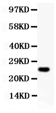 Western blot analysis of Cyclin D3 using anti-Cyclin D3 antibody (PB9103). Electrophoresis was performed on a 5-20% SDS-PAGE gel at 70V (Stacking gel) / 90V (Resolving gel) for 2-3 hours. lane 1: recombinant human Cyclin D3 protein 0.5ng. After Electrophoresis, proteins were transferred to a Nitrocellulose membrane at 150mA for 50-90 minutes. Blocked the membrane with 5% Non-fat Milk/ TBS for 1.5 hour at RT. The membrane was incubated with rabbit anti-Cyclin D3 antigen affinity purified polyclonal antibody (Catalog # PB9103) at 0.5 μg/mL overnight at 4°C, then washed with TBS-0.1%Tween 3 times with 5 minutes each and probed with a goat anti-rabbit IgG-HRP secondary antibody at a dilution of 1:10000 for 1.5 hour at RT. The signal is developed using an Enhanced Chemiluminescent detection (ECL) kit (Catalog # EK1002) with Tanon 5200 system. A specific band was detected for Cyclin D3 at approximately 25KD. The expected band size for Cyclin D3 is at 25KD.