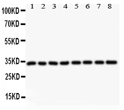 Western blot analysis of Cyclin D4 using anti-Cyclin D4 antibody (PB9103). Electrophoresis was performed on a 5-20% SDS-PAGE gel at 70V (Stacking gel) / 90V (Resolving gel) for 2-3 hours. The sample well of each lane was loaded with 50ug of sample under reducing conditions. lane 1: rat testis tissue lysate, lane 2: rat thymus tissue lysate, lane 3: rat lung tissue lysate, lane 4: rat ovary tissue lysate, lane 5: JURKAT whole cell lysate, lane 6: A549 whole cell lysate, lane 7: MCF-7 whole cell lysate, lane 8: HELA whole cell lysate. After Electrophoresis, proteins were transferred to a Nitrocellulose membrane at 150mA for 50-90 minutes. Blocked the membrane with 5% Non-fat Milk/ TBS for 1.5 hour at RT. The membrane was incubated with rabbit anti-Cyclin D4 antigen affinity purified polyclonal antibody (Catalog # PB9103) at 0.5 μg/mL overnight at 4°C, then washed with TBS-0.1%Tween 3 times with 5 minutes each and probed with a goat anti-rabbit IgG-HRP secondary antibody at a dilution of 1:10000 for 1.5 hour at RT. The signal is developed using an Enhanced Chemiluminescent detection (ECL) kit (Catalog # EK1002) with Tanon 5200 system. A specific band was detected for Cyclin D4 at approximately 33KD. The expected band size for Cyclin D4 is at 33KD.