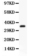 Western blot analysis of FSH beta using anti-FSH beta antibody (PB9106).