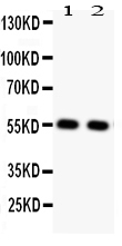 Western blot analysis of GLUT4 using anti-GLUT4 antibody (PB9109). Electrophoresis was performed on a 5-20% SDS-PAGE gel at 70V (Stacking gel) / 90V (Resolving gel) for 2-3 hours. The sample well of each lane was loaded with 50ug of sample under reducing conditions. lane 1: rat cardiac muscle tissue lysate, lane 2: rat skeletal muscle tissue lysate. After Electrophoresis, proteins were transferred to a Nitrocellulose membrane at 150mA for 50-90 minutes. Blocked the membrane with 5% Non-fat Milk/ TBS for 1.5 hour at RT. The membrane was incubated with rabbit anti-GLUT4 antigen affinity purified polyclonal antibody (Catalog # PB9109) at 0.5 μg/mL overnight at 4°C, then washed with TBS-0.1%Tween 3 times with 5 minutes each and probed with a goat anti-rabbit IgG-HRP secondary antibody at a dilution of 1:10000 for 1.5 hour at RT. The signal is developed using an Enhanced Chemiluminescent detection (ECL) kit (Catalog # EK1002) with Tanon 5200 system. A specific band was detected for GLUT4 at approximately 55KD. The expected band size for GLUT4 is at 55KD.