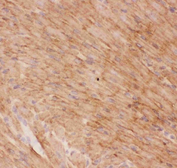 IHC analysis of GLUT4 using anti-GLUT4 antibody (PB9109). GLUT4 was detected in frozen section of rat cardiac muscle tissues. The tissue section was blocked with 10% goat serum. The tissue section was then incubated with 1μg/ml rabbit anti-GLUT4 Antibody (PB9109) overnight at 4°C. Biotinylated goat anti-rabbit IgG was used as secondary antibody and incubated for 30 minutes at 37°C. The tissue section was developed using Strepavidin-Biotin-Complex (SABC)(Catalog # SA1022) with DAB as the chromogen.