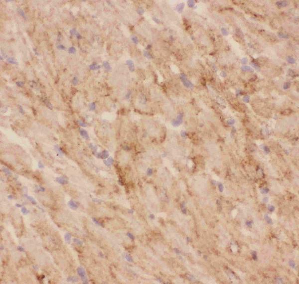 IHC analysis of GLUT4 using anti-GLUT4 antibody (PB9109). GLUT4 was detected in frozen section of mouse cardiac muscle tissues. The tissue section was blocked with 10% goat serum. The tissue section was then incubated with 1μg/ml rabbit anti-GLUT4 Antibody (PB9109) overnight at 4°C. Biotinylated goat anti-rabbit IgG was used as secondary antibody and incubated for 30 minutes at 37°C. The tissue section was developed using Strepavidin-Biotin-Complex (SABC)(Catalog # SA1022) with DAB as the chromogen.