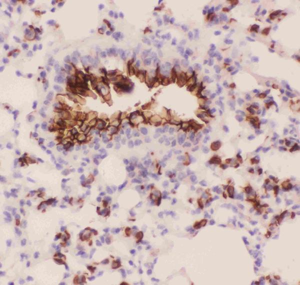 IHC analysis of MUC1 using anti-MUC1 antibody (PB9112). MUC1 was detected in paraffin-embedded section of mouse lung tissues. Heat mediated antigen retrieval was performed in citrate buffer (pH6, epitope retrieval solution) for 20 mins. The tissue section was blocked with 10% goat serum. The tissue section was then incubated with 1μg/ml rabbit anti-MUC1 Antibody (PB9112) overnight at 4°C. Biotinylated goat anti-rabbit IgG was used as secondary antibody and incubated for 30 minutes at 37°C. The tissue section was developed using Strepavidin-Biotin-Complex (SABC)(Catalog # SA1022) with DAB as the chromogen.