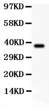 Western blot analysis of CIAS1/NALP3 using anti-CIAS1/NALP3 antibody (PB9114).