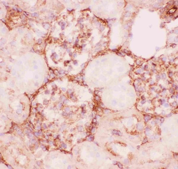 Anti-P Glycoprotein Picoband antibody, RP1034-2.JPG IHC(F): Rat Kidney Tissue