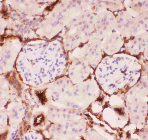 Anti-P Glycoprotein Picoband antibody, RP1034-4.JPG IHC(P): Mouse Kidney Tissue