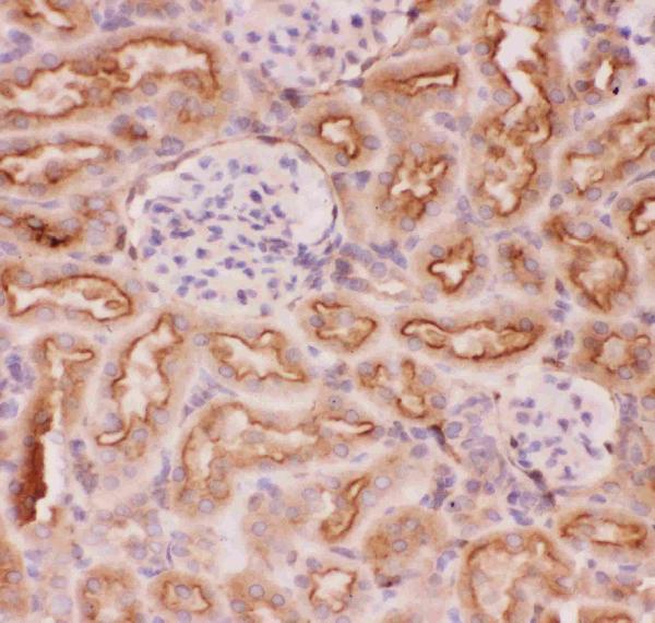 Anti-P Glycoprotein Picoband antibody, RP1034-5.JPG IHC(P): Rat Kidney Tissue