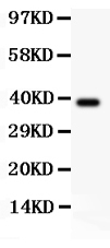 Western blot analysis of RIP using anti-RIP antibody (PB9116).