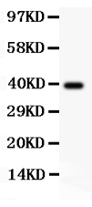 Western blot analysis of AP2 alpha using anti-AP2 alpha antibody (PB9118).