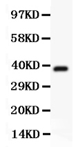 Western blot analysis of Hamartin using anti-Hamartin antibody (PB9120).