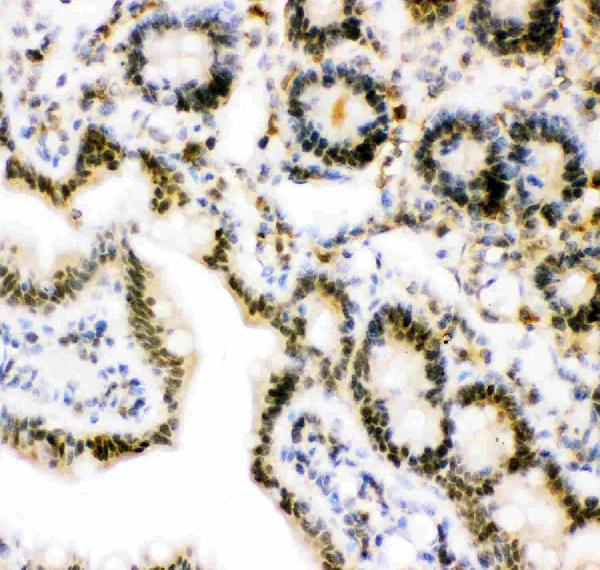 IHC analysis of Ubiquitin using anti-Ubiquitin antibody (PB9122). Ubiquitin was detected in paraffin-embedded section of rat intestine tissue. Heat mediated antigen retrieval was performed in citrate buffer (pH6, epitope retrieval solution) for 20 mins. The tissue section was blocked with 10% goat serum. The tissue section was then incubated with 1μg/ml rabbit anti-Ubiquitin Antibody (PB9122) overnight at 4°C. Biotinylated goat anti-rabbit IgG was used as secondary antibody and incubated for 30 minutes at 37°C. The tissue section was developed using Strepavidin-Biotin-Complex (SABC)(Catalog # SA1022) with DAB as the chromogen.