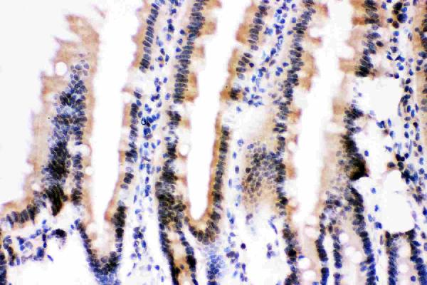 IHC analysis of Ubiquitin using anti-Ubiquitin antibody (PB9122). Ubiquitin was detected in paraffin-embedded section of mouse intestine tissue. Heat mediated antigen retrieval was performed in citrate buffer (pH6, epitope retrieval solution) for 20 mins. The tissue section was blocked with 10% goat serum. The tissue section was then incubated with 1μg/ml rabbit anti-Ubiquitin Antibody (PB9122) overnight at 4°C. Biotinylated goat anti-rabbit IgG was used as secondary antibody and incubated for 30 minutes at 37°C. The tissue section was developed using Strepavidin-Biotin-Complex (SABC)(Catalog # SA1022) with DAB as the chromogen.