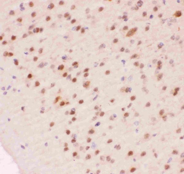 IHC analysis of APEX1 using anti-APEX1 antibody (PB9128). APEX1 was detected in paraffin-embedded section of mouse brain tissue. Heat mediated antigen retrieval was performed in citrate buffer (pH6, epitope retrieval solution) for 20 mins. The tissue section was blocked with 10% goat serum. The tissue section was then incubated with 1μg/ml rabbit anti-APEX1 Antibody (PB9128) overnight at 4°C. Biotinylated goat anti-rabbit IgG was used as secondary antibody and incubated for 30 minutes at 37°C. The tissue section was developed using Strepavidin-Biotin-Complex (SABC)(Catalog # SA1022) with DAB as the chromogen.