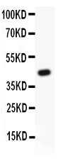 Western blot analysis of HIF1 using anti-HIF1 antibody (PB9129).