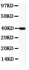 Western blot analysis of MCL1 using anti-MCL1 antibody (PB9132).