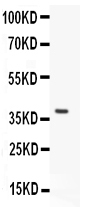 Western blot analysis of HOXA11 using anti-HOXA11 antibody (PB9218). Electrophoresis was performed on a 5-20% SDS-PAGE gel at 70V (Stacking gel) / 90V (Resolving gel) for 2-3 hours. lane 1: Recombinant Human HOXA11 Protein 0.5ng. After Electrophoresis, proteins were transferred to a Nitrocellulose membrane at 150mA for 50-90 minutes. Blocked the membrane with 5% Non-fat Milk/ TBS for 1.5 hour at RT. The membrane was incubated with rabbit anti-HOXA11 antigen affinity purified polyclonal antibody (Catalog # PB9218) at 0.5 μg/mL overnight at 4°C, then washed with TBS-0.1%Tween 3 times with 5 minutes each and probed with a goat anti-rabbit IgG-HRP secondary antibody at a dilution of 1:10000 for 1.5 hour at RT. The signal is developed using an Enhanced Chemiluminescent detection (ECL) kit (Catalog # EK1002) with Tanon 5200 system. A specific band was detected for HOXA11 at approximately 38KD. The expected band size for HOXA11 is at 38KD.