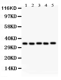 Western blot analysis of HOXA11 using anti-HOXA11 antibody (PB9218). Electrophoresis was performed on a 5-20% SDS-PAGE gel at 70V (Stacking gel) / 90V (Resolving gel) for 2-3 hours. The sample well of each lane was loaded with 50ug of sample under reducing conditions. Lane 1: Rat Brain Tissue Lysate, Lane 2: Human Placenta Tissue Lysate, Lane 3: HLEA Whole Cell Lysate, Lane 4: HT1080 Whole Cell Lysate, Lane 5: HEPA Whole Cell Lysate. After Electrophoresis, proteins were transferred to a Nitrocellulose membrane at 150mA for 50-90 minutes. Blocked the membrane with 5% Non-fat Milk/ TBS for 1.5 hour at RT. The membrane was incubated with rabbit anti-HOXA11 antigen affinity purified polyclonal antibody (Catalog # PB9218) at 0.5 μg/mL overnight at 4°C, then washed with TBS-0.1%Tween 3 times with 5 minutes each and probed with a goat anti-rabbit IgG-HRP secondary antibody at a dilution of 1:10000 for 1.5 hour at RT. The signal is developed using an Enhanced Chemiluminescent detection (ECL) kit (Catalog # EK1002) with Tanon 5200 system. A specific band was detected for HOXA11 at approximately 35KD. The expected band size for HOXA11 is at 35KD.