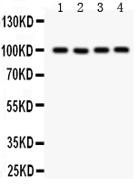 Anti-TRP 7 Picoband antibody, PB9272, Western blotting All lanes: Anti TRP 7 (PB9272) at 0.5ug/ml Lane 1: Mouse Brain Tissue Lysate at 50ug Lane 2: A549 Whole Cell Lysate at 40ug Lane 3: COLO320 Whole Cell Lysate at 40ug Lane 4: SKOV Whole Cell Lysate at 40ug Predicted bind size: 99KD Observed bind size: 99KD