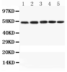 Anti-Caspase 8 Picoband antibody, PB9331, Western blotting All lanes: Anti Caspase 8 (PB9331) at 0.5ug/ml Lane 1: Mouse Spleen Tissue Lysate at 50ug Lane 2: Mouse Thymus Tissue Lysate at 50ug Lane 3: Mouse Kidney Tissue Lysate at 50ug Lane 4: Mouse Lung Tissue Lysate at 50ug Lane 5: HEPA Cell Lysate at 40ug Predicted bind size: 55KD Observed bind size: 55KD