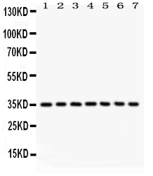 Anti-Caspase-9 Picoband antibody, PB9332, Western blotting All lanes: Anti Caspase-9 (PB9332) at 0.5ug/ml Lane 1: A549 Whole Cell Lysate at 40ug Lane 2: SMMC Whole Cell Lysate at 40ug Lane 3: 293T Whole Cell Lysate at 40ug Lane 4: JURKAT Whole Cell Lysate at 40ug Lane 5: RAJI Whole Cell Lysate at 40ug Lane 6: CEM Whole Cell Lysate at 40ug Lane 7: HUT Whole Cell Lysate at 40ug Predicted bind size: 35KD Observed bind size: 35KD