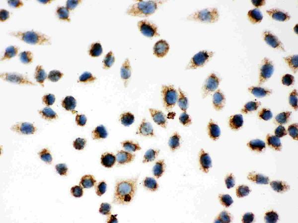 IHC analysis of Hsp60 using anti-Hsp60 antibody (PB9337). Hsp60 was detected in immunocytochemical section of SMMC-7721 Cell. Enzyme antigen retrieval was performed using IHC enzyme antigen retrieval reagent (AR0022) for 15 mins. The cells were blocked with 10% goat serum. And then incubated with 1μg/ml rabbit anti-Hsp60 Antibody (PB9337) overnight at 4°C. Biotinylated goat anti-rabbit IgG was used as secondary antibody and incubated for 30 minutes at 37°C. The section was developed using Strepavidin-Biotin-Complex (SABC)(Catalog # SA1022) with DAB as the chromogen.